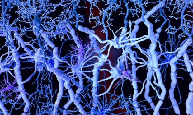 کشف جدید دانشمندان درباره پیشرفت بیماری آلزایمر