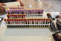 آزمایش ملکولی بسیار پیشرفته NAT برای اولین بار در کشور