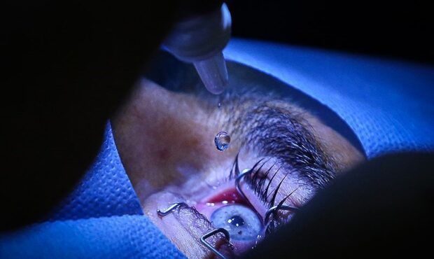 عمل تغییر رنگ چشم عوارض خطرناکی دارد