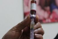 توزیع واکسن روتاویروس آغاز شد توزیع واکسن روتاویروس آغاز شد