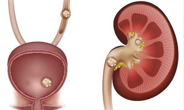 این داروها برای کلیه شما سم خالص است